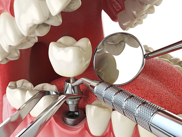 Best Dentist for Tooth Abscess  in Chisholm, ME